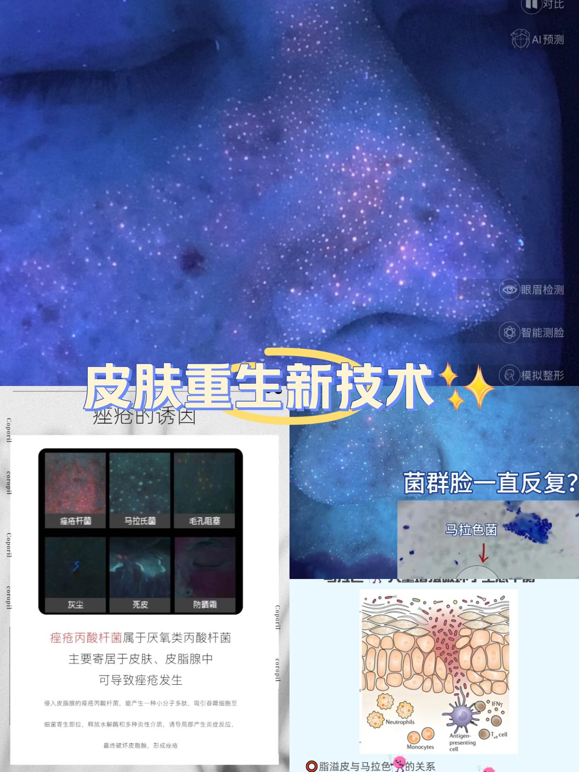卟咻_卟咻症是什么
